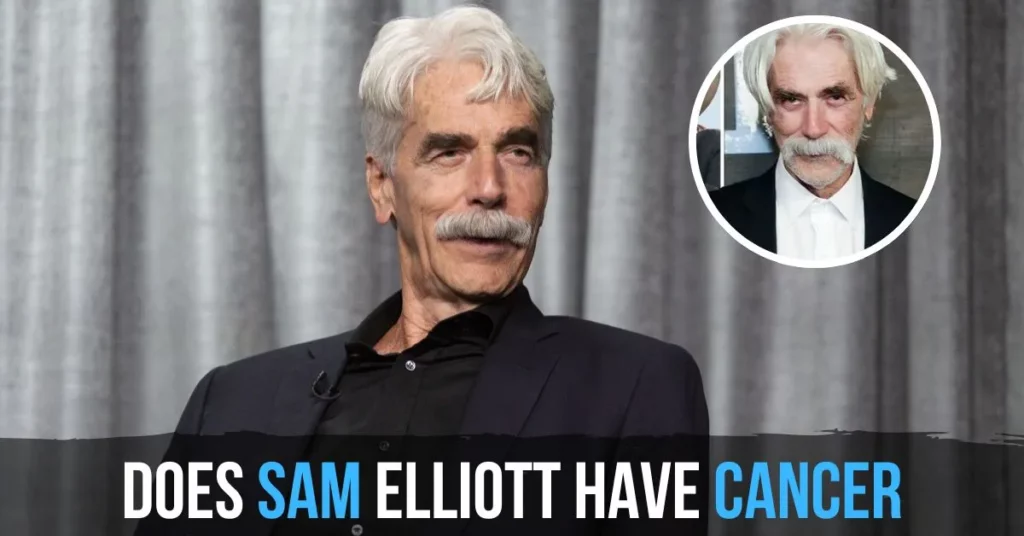 Does Sam Elliott Have Cancer