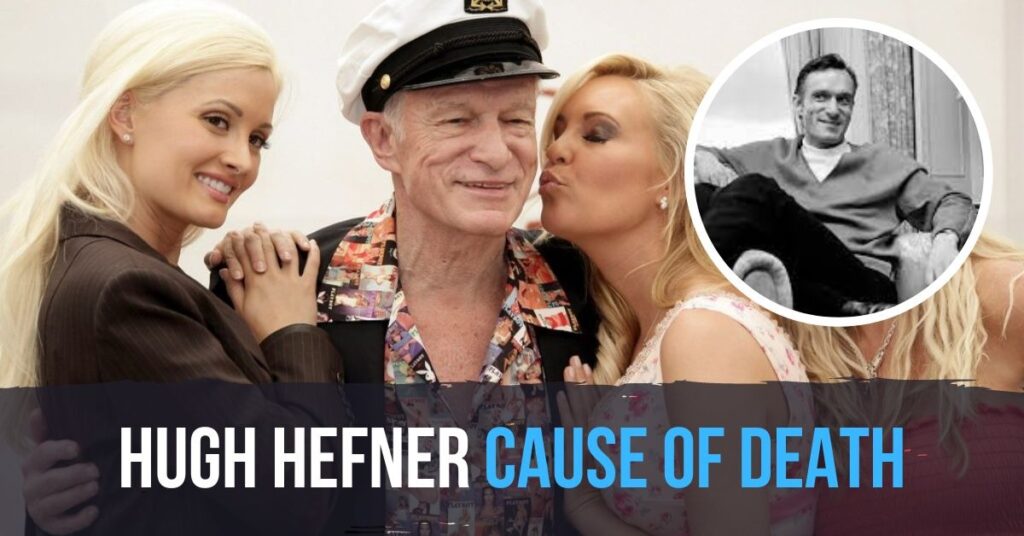 Hugh Hefner Cause Of Death