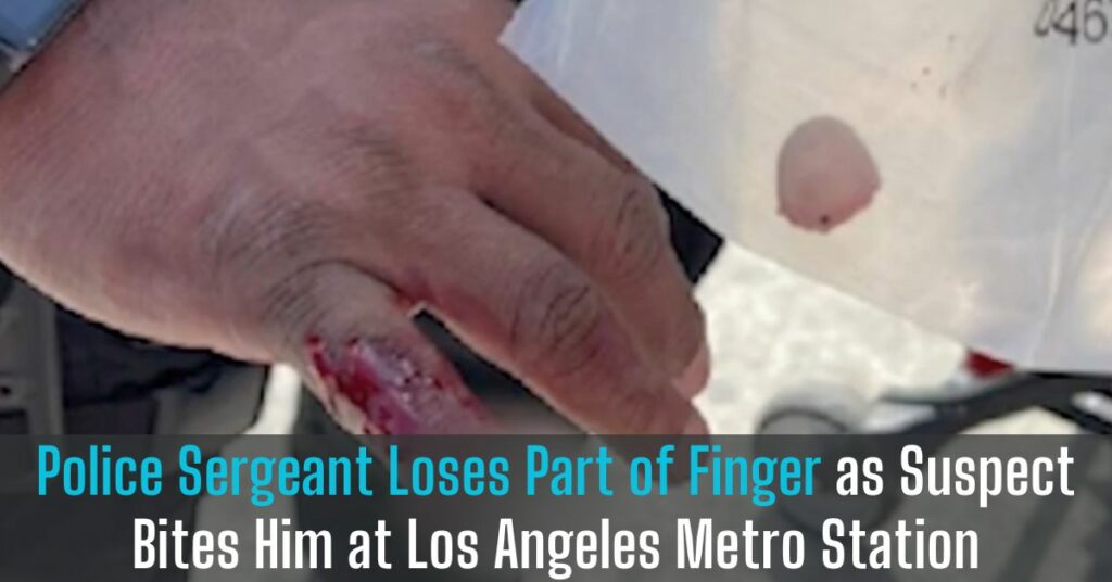 Police Sergeant Loses Part of Finger as Suspect Bites Him at Los Angeles Metro Station