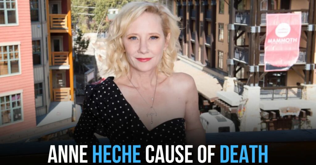 Anne Heche Cause of Death