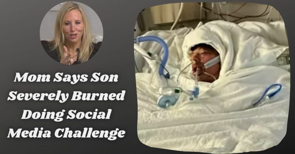 Mom Says Son Severely Burned Doing Social Media Challenge