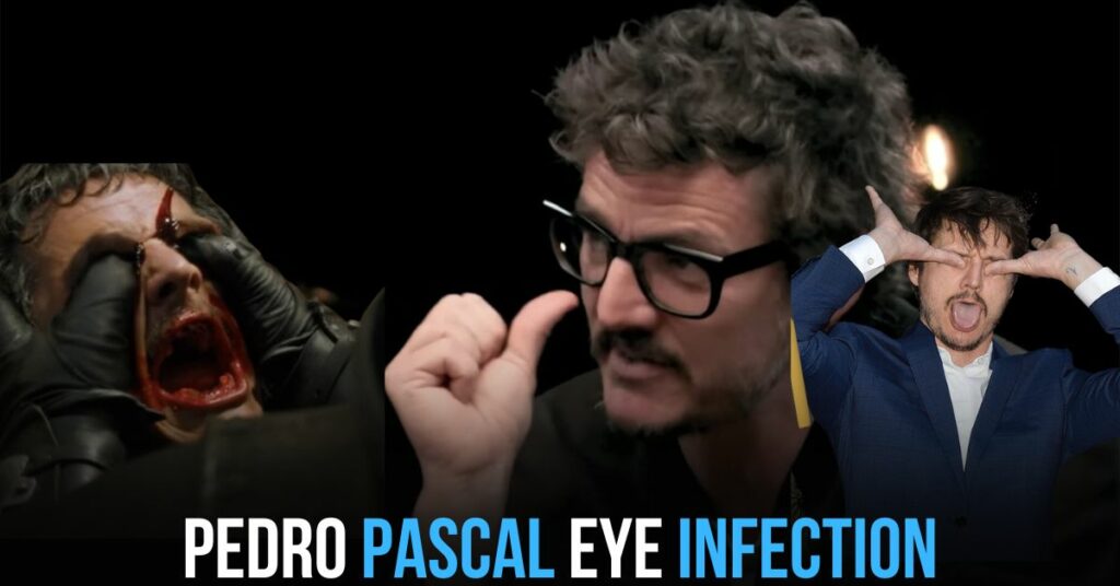 Pedro Pascal Eye Infection