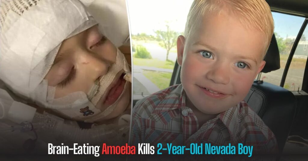 Brain-Eating Amoeba Kills 2-Year-Old Nevada Boy